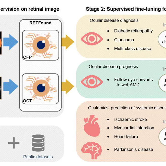 A foundation model for generalizable disease detection from retinal images