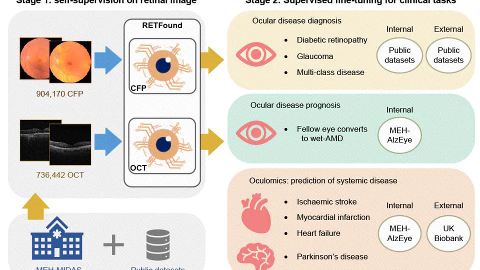 A foundation model for generalizable disease detection from retinal images